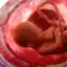 dilniya