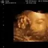 Fatma_1983