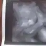 eylemcb