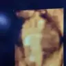 burcuken
