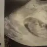 elisamaysem