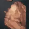Sedaserefoglu
