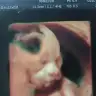 sedemosmi