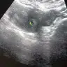 Minnnk