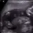 tiryak