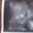 eylemcb