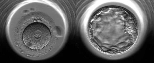 Embriyolar artık fotoğraflardan seçiliyor…