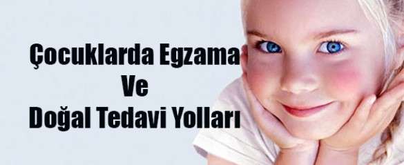 Çocuklarda Egzama Ve Doğal Tedavi Yolları Kadınlar Kulübü