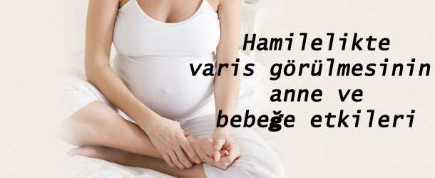 Hamilelikte varis görülmesinin anne ve bebeğe etkileri