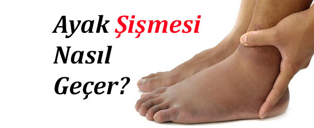 Ayak Şişmesi Tedavisi İçin 9 Öneri