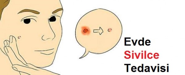 Evde Sivilce Tedavisi Nasıl Yapılır? Kadınlar Kulübü