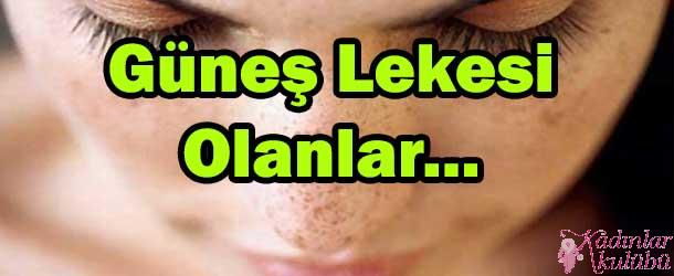 Güneş lekesi olanlar