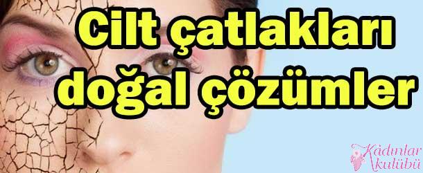 Cilt çatlakları doğal çözümler