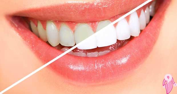 Sararmış dişler için Doğal diş beyazlatma
