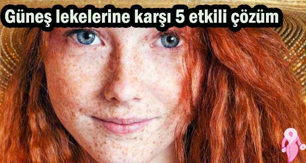 Güneş lekelerine karşı 5 etkili çözüm