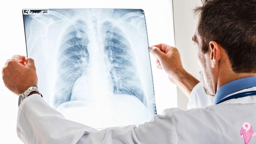 Gebelikte röntgen