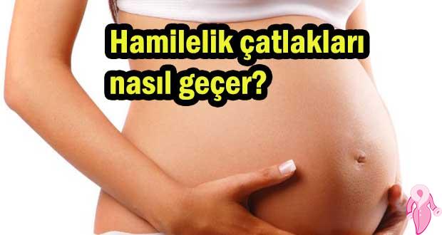 Hamilelik çatlakları nasıl geçer?