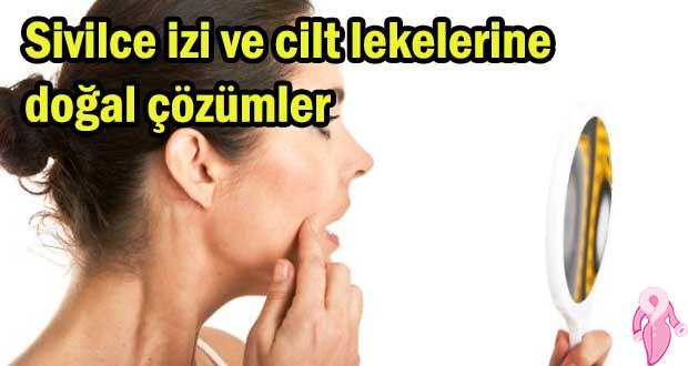 Sivilce izi ve cilt lekelerine doğal çözümler