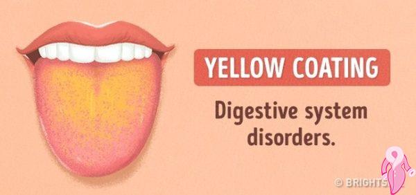 Dil Renginden Hastalık Analizi | 23