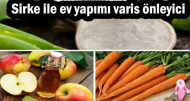 Sirke ile ev yapımı varis önleyici