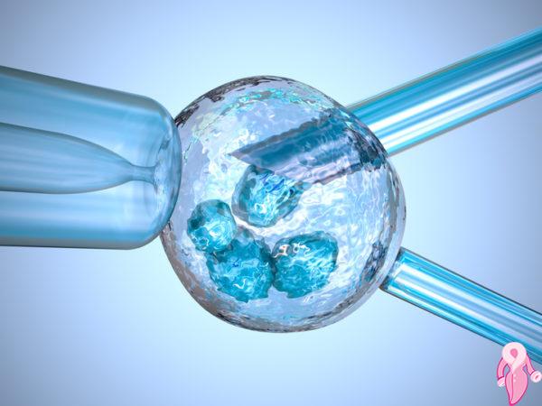 Tüp Bebek Tedavilerinde Genetik Tarama Kimlere Önerilir ? | 2