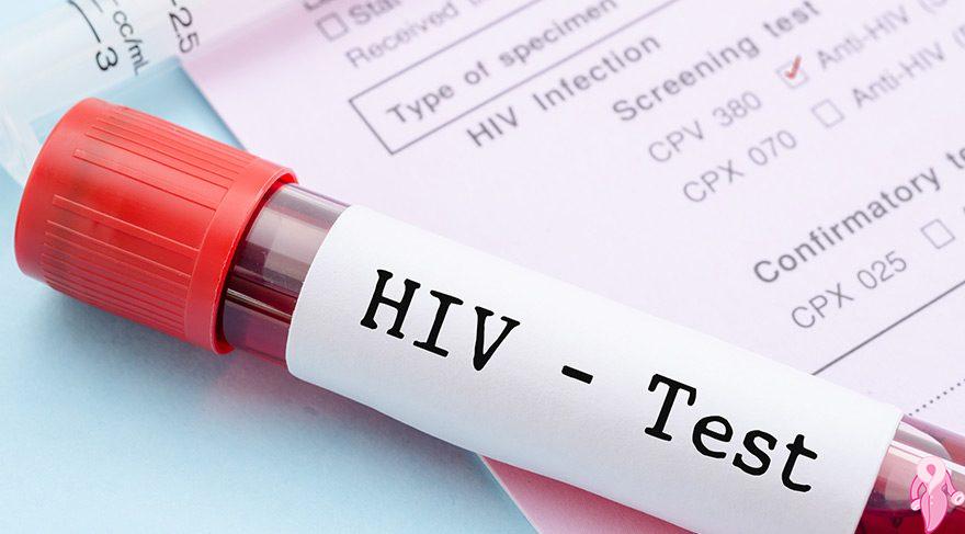 Anti HIV nedir? Anti HIV Non Reactive Ne Demek? Anti HIV Testi Sonucu Reactive İse Ne Anlama Gelir?