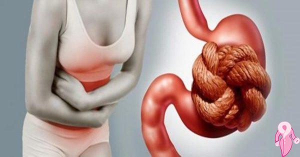 Kabızlık Nasıl Geçer? Kabızlığa En Hızlı Bitkisel Tedavisi Çözüm | 2