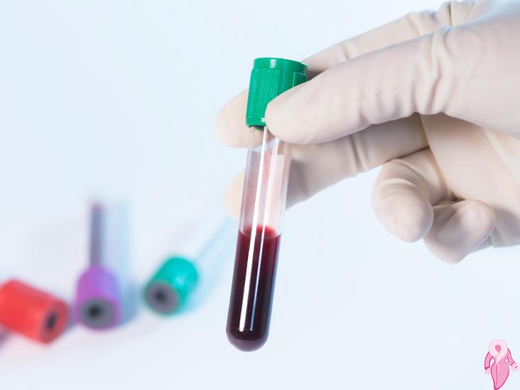 Hamilelikte PLT Düşüklüğü Nedenleri Nelerdir? Trombosit Tedavisi Hamilelikte PLT Düşüklüğü Nedenleri Nelerdir? Trombosit Tedavisi