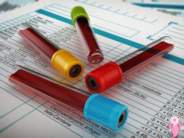 Kreatinin Düşüklüğü Yüksekliği Nedir? Normal Değeri Kaç Olmalıdır? | 12