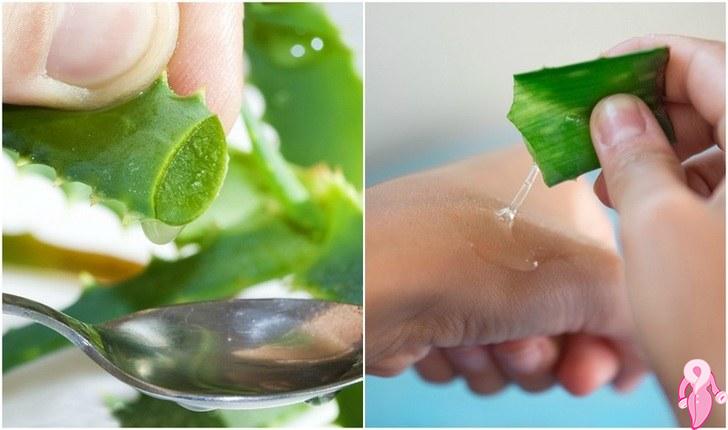 Aloe Vera Cilt Lekelerine İyi Gelir Mi?