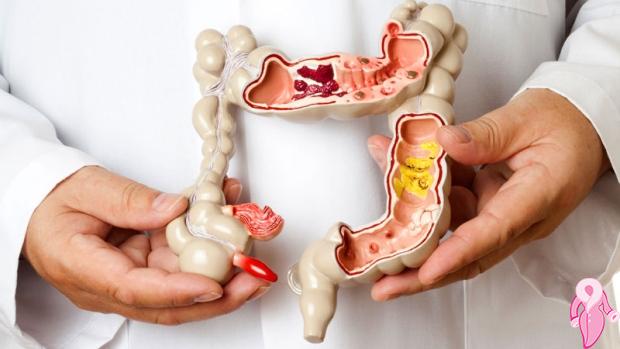 Crohn Hastalığı Nedir, Nasıl Tedavi Edilir?