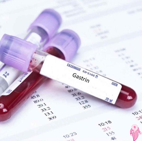 Gastrin Nedir, Gastrin Hormonu Yüksekliği Düşüklüğü Ve Normal Değerleri | 2