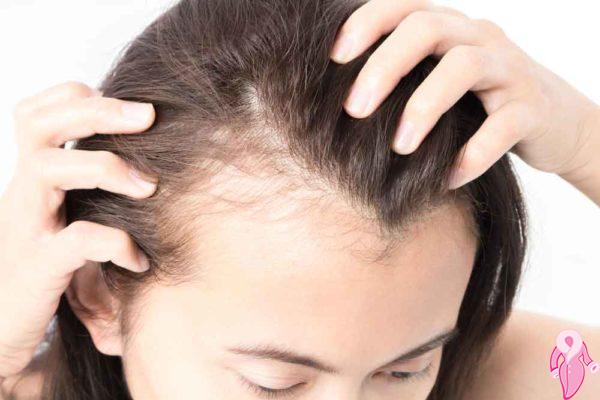 Wie kann man Haarausfall nach der Geburt verhindern?