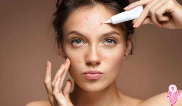 Kistik Sivilce İzleri Nasıl Geçer? Maske Tarifleri | 14