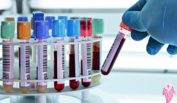 Total Bilirubin Yüksekliği Nasıl Düşürülür? | 1
