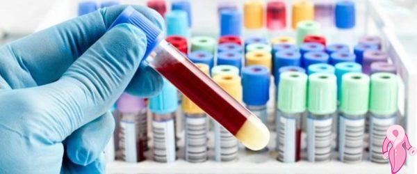Total Bilirubin Yüksekliği Nasıl Düşürülür?