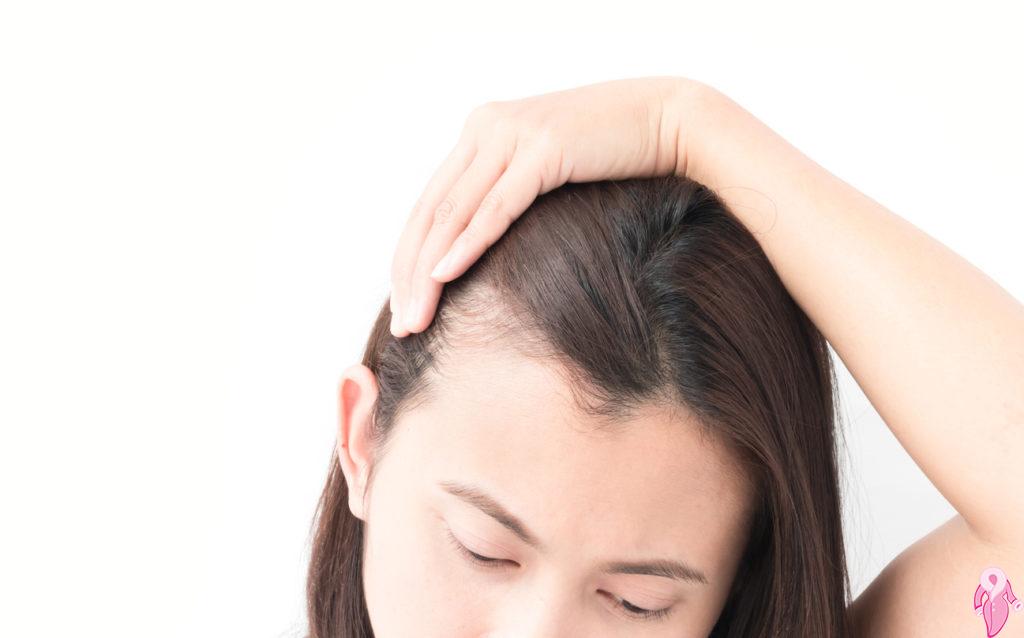 Saç Dökülmesi Hangi Vitamin Eksikliğinde Görülür?