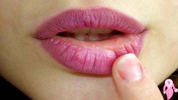Fast Herpes Relief Methods Natural And Chemical!