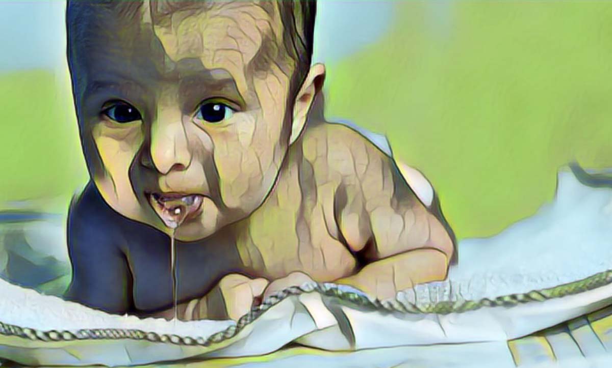 Bebeklerde Reflünün Sebepleri Nelerdir, Nasıl Tedavi Edilir?