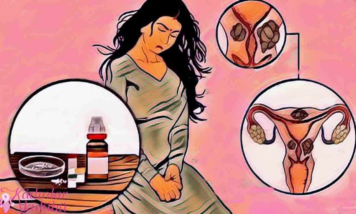 Miyom Nedir? Rahim Fibroidleri 10 Belirtisi Ve Tedavisi Kadınlar Kulübü