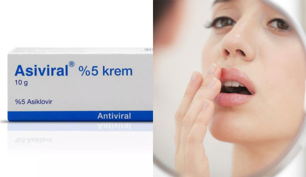Asiviral Krem: Neye İyi Gelir ve Nasıl Kullanılır?