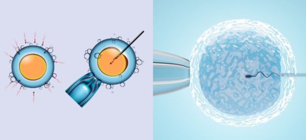 ICSI ve IVF Arasındaki Farklar
