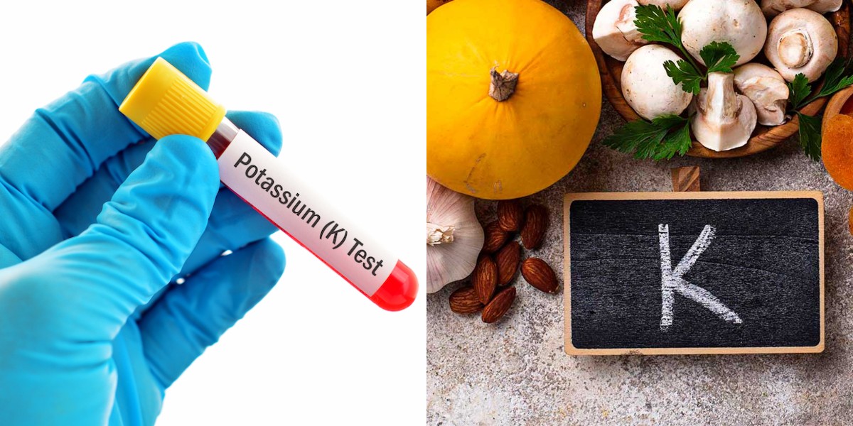 Potasyum ne işe yarar? Fazlalığı ve Düşüklüğü Nelere yol açar?
