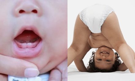 Bebeklerde diş çıkarma pişik yapar mı?