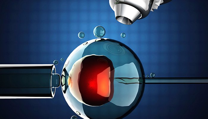 Tüp Bebekte Kişiye Özel Embriyo Transferi