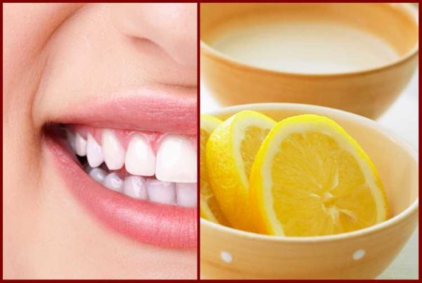 Einfache Methoden der Zahnaufhellung zu Hause