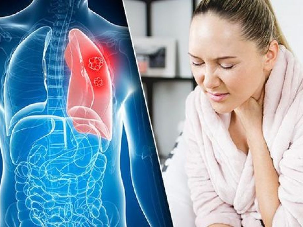 Akciğer Kanserinin İlk 5 Belirtisi Ve Ölüm Belirtileri