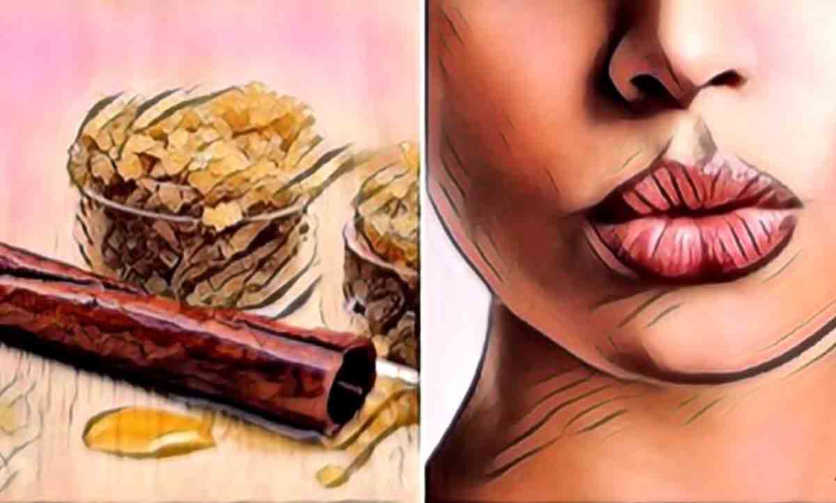 Cinnamon Lip Plumper – 15 einfache Rezepte für pralle und schöne Lippen