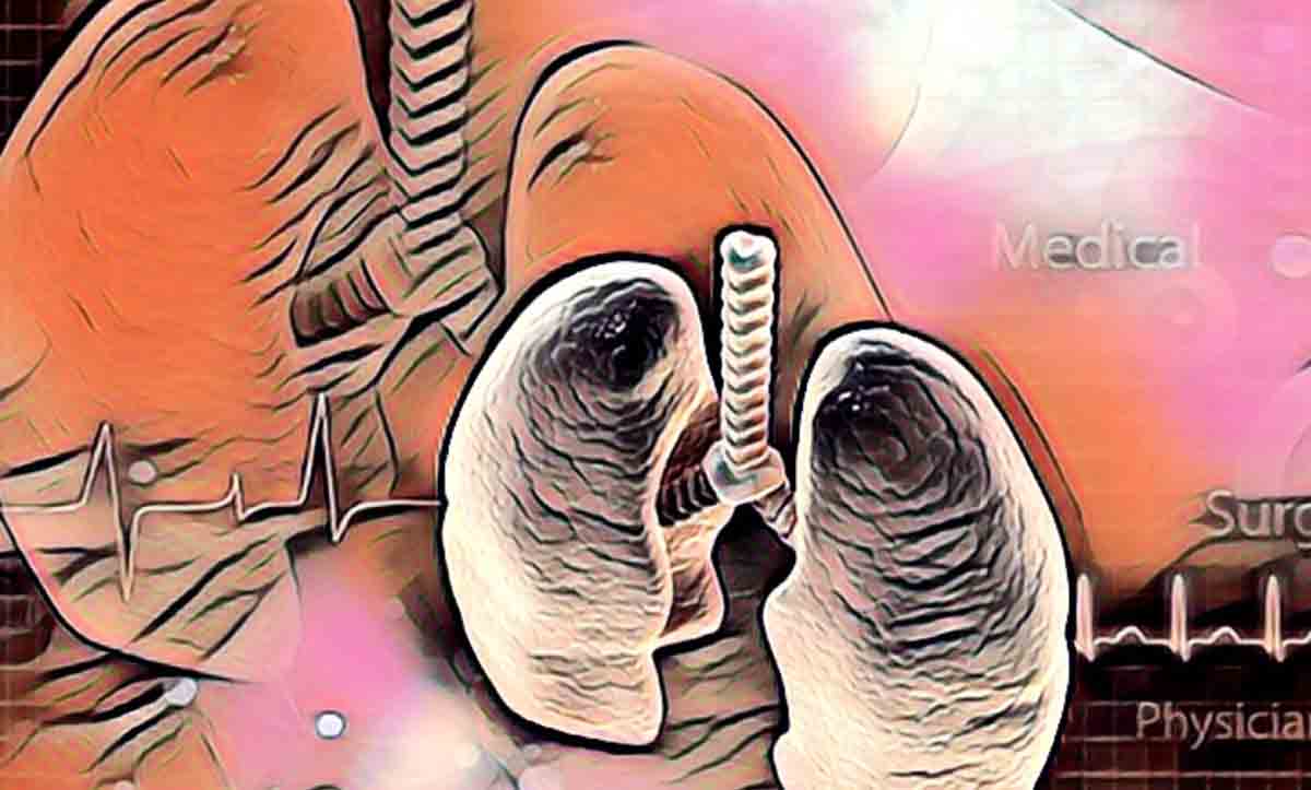 Romatoid artrit ile ilişkili interstisyel akciğer hastalığı